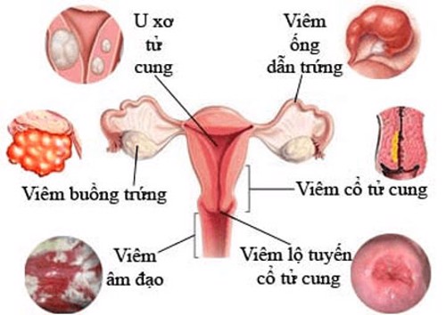 4 bệnh dễ gặp khi thức khuya ở phụ nữ     